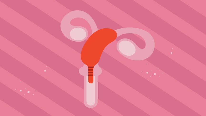 How to Use a Menstrual Cup with a Tilted Uterus